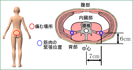 これらが圧迫された場合